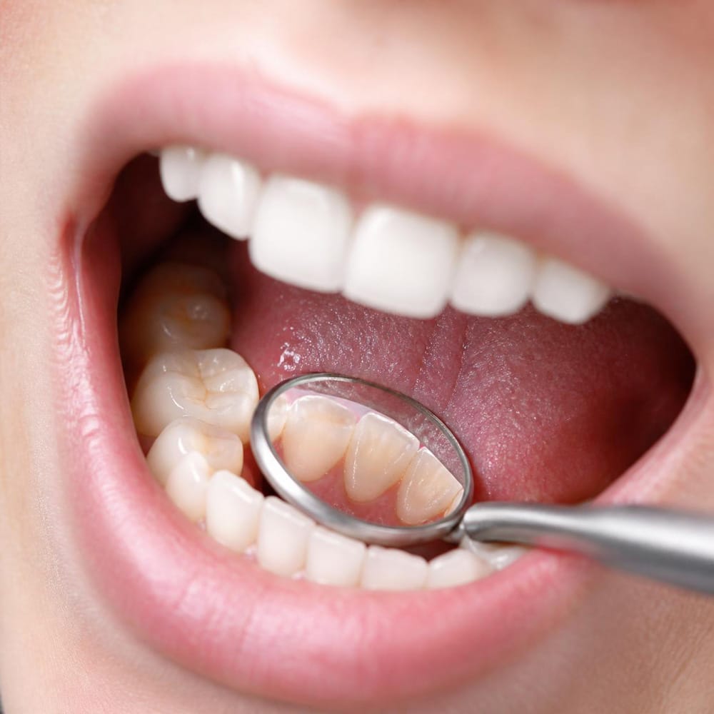 dental check-up in Clacton-on-Sea