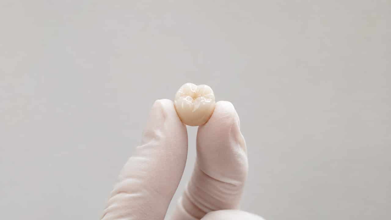 How Long Does a Dental Crown Last?