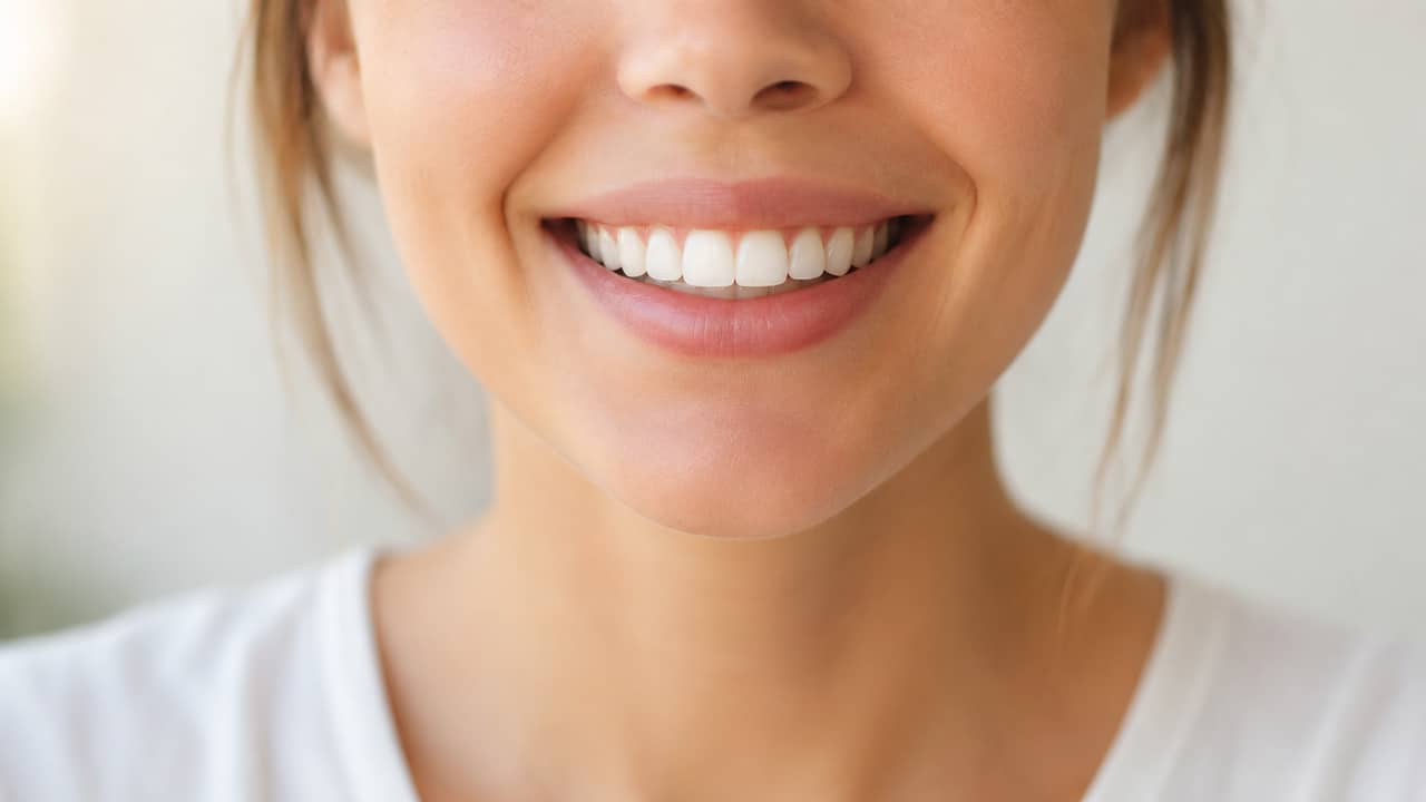 How to Straighten Front Teeth Quickly
